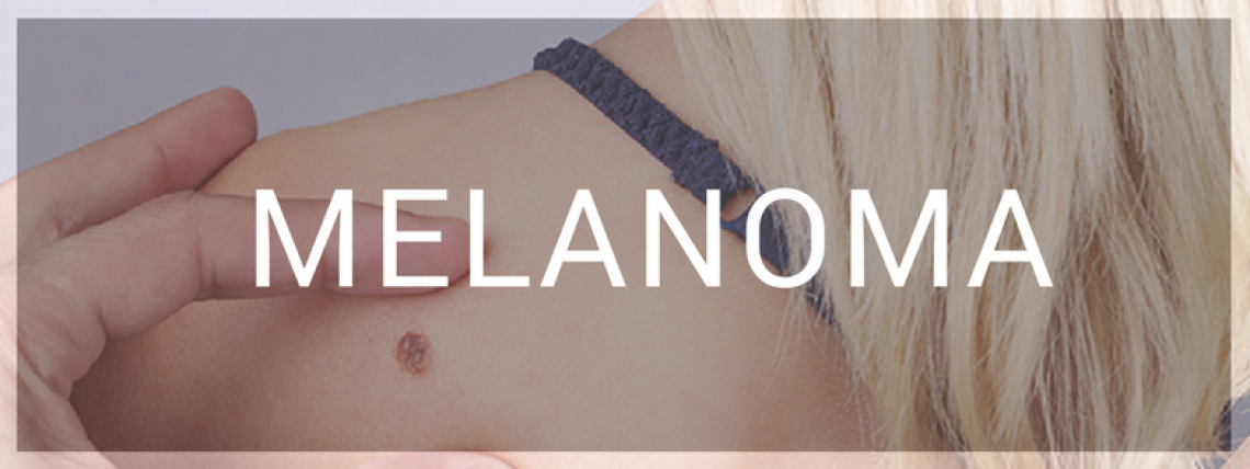 MELANOMA